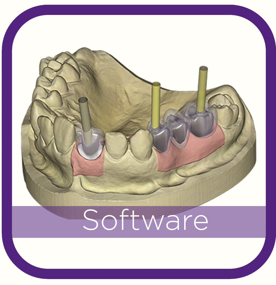 Exocad Dental Software