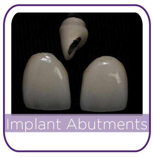 Implant Abutment Alternatives MAIN