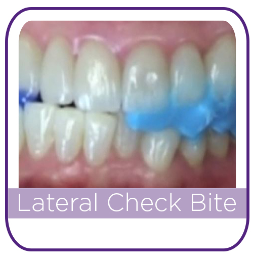 Check Bite THUMBNAIL