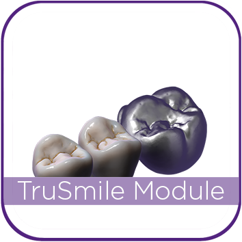 Exocad TruSmile Module MAIN