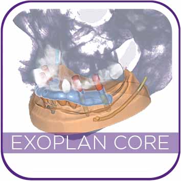 EXOPLAN CORE VERSION (DESIGN ONLY) THUMBNAIL