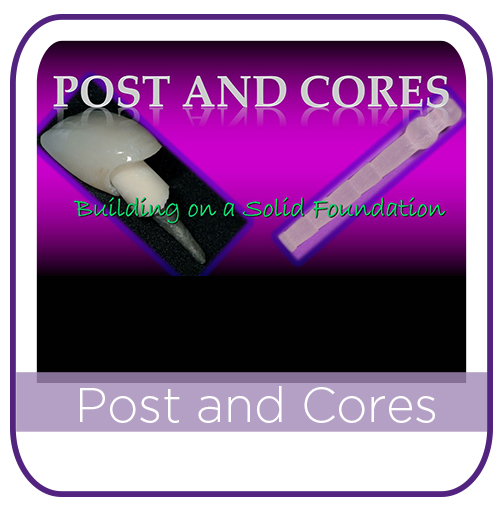 Post and Core MAIN