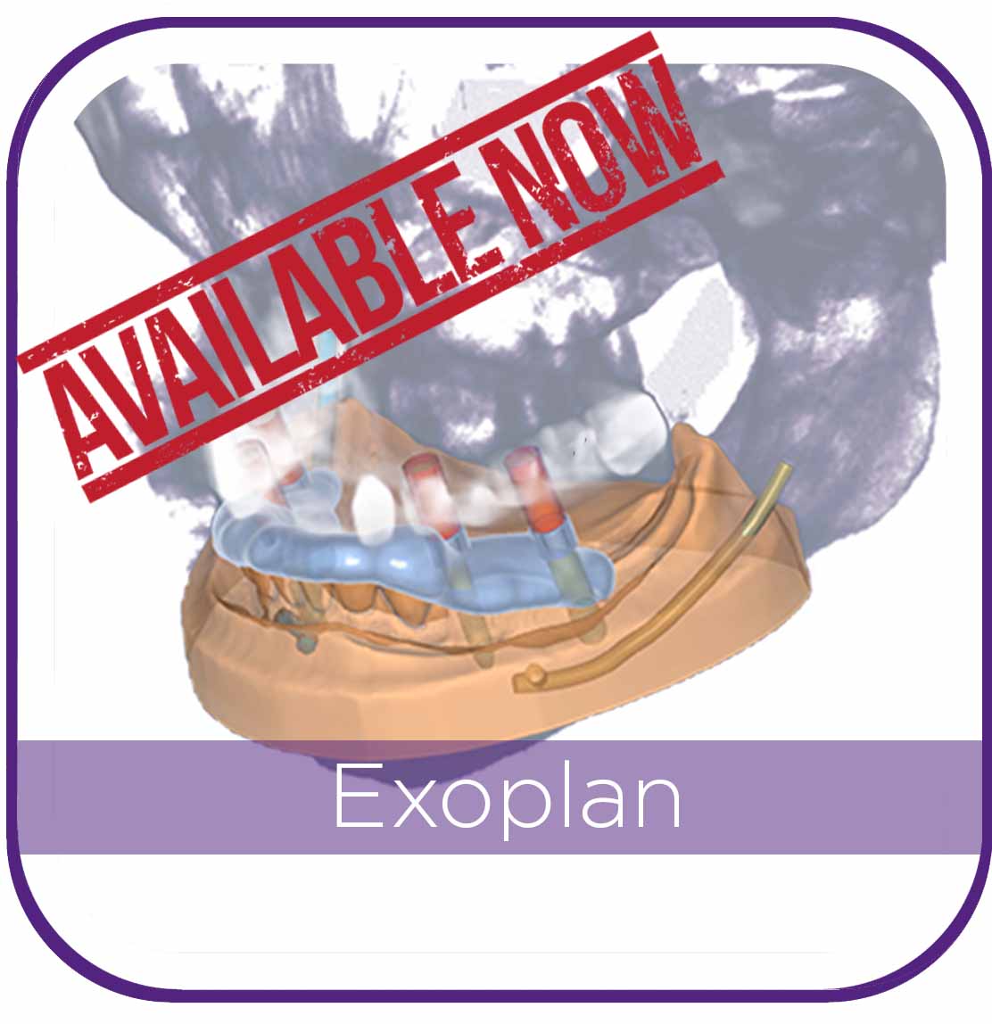 EXOPLAN