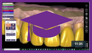 EXOCAD Denture Video 3 THUMBNAIL