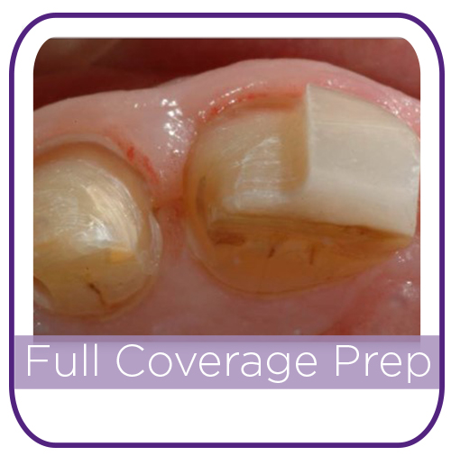 Preparation MAIN