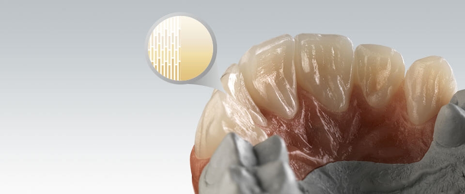 Ceramill Zolid fx ML 98 (A2/A3) THUMBNAIL