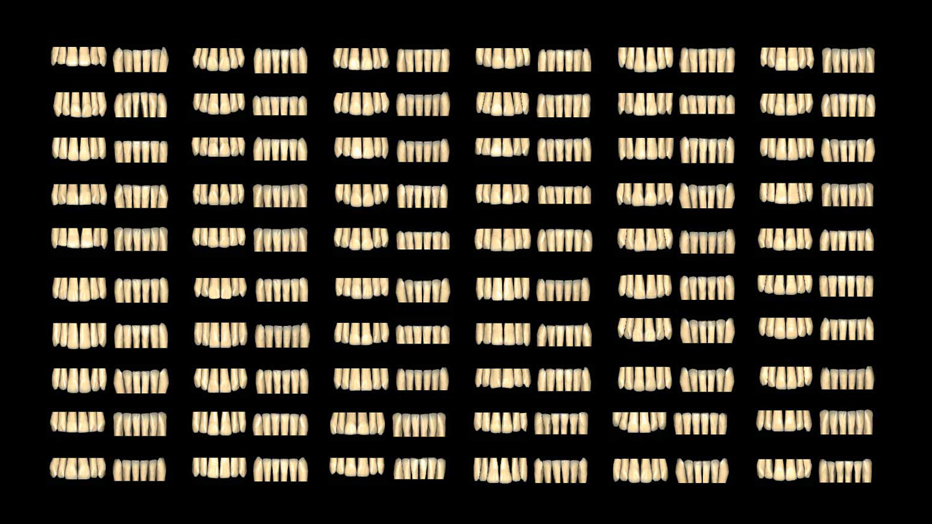 Exocad Ultimate Lab Bundle SWATCH