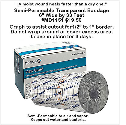 MD1151 Transparent View Guard Dressing Bandage MAIN