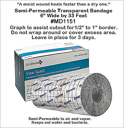MD1151 Transparent View Guard Dressing Bandage MAIN