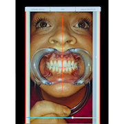 MaxAlign Doctor Kit THUMBNAIL