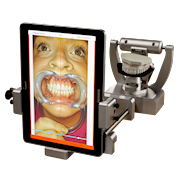 MaxAlign Lab Kit THUMBNAIL